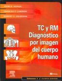 Cover of: Tomografia Computadorizada y Resonancia Magnetica del Cuerpo Humano: 2-Volume Set