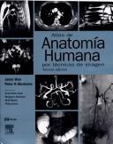 Cover of: Atlas Radiologico De Anatomia Humana by Jamie Weir