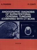 Cover of: Angiographic Diag Cereb Tumor