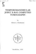 Cover of: Temporomandibular joint X-ray computed tomography: methodology and clinical applications