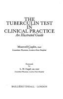 Cover of: The tuberculin test in clinical practice: an illustrated guide