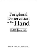 Peripheral denervation of the hand by Carl Damien Enna