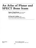 Cover of: An atlas of planar and SPECT bone scans