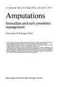 Cover of: Amputations by J. J. Gerhardt