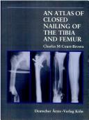 Cover of: An atlas of closed nailing of the tibia and femur
