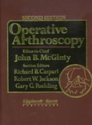 Cover of: Operative arthroscopy