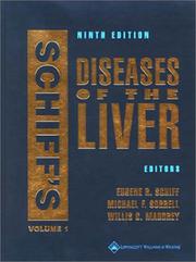 Schiff's diseases of the liver by Eugene R. Schiff, Eugene R Schiff, Michael F Sorrell, Willis C Maddrey