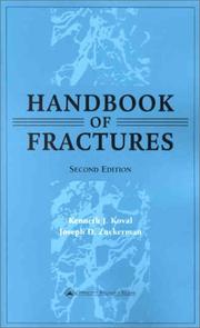 Cover of: Handbook Of Fractures by Joseph D. Zuckerman, Kenneth J. Koval
