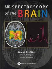 Cover of: MR Spectroscopy of the Brain by Lara A Brandão, Romeu C Domingues