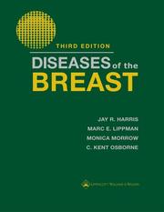 Diseases of the breast by Jay R Harris, Marc E Lippman, Monica Morrow, C. Kent Osborne