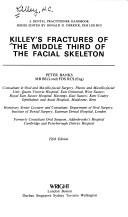 Cover of: Killey's fractures of the middle third of the facial skeleton. by 
