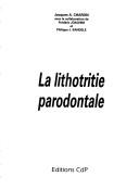 Cover of: La lithotritie parodontale by Jacques A. Charon