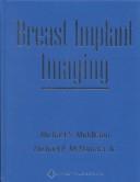 Cover of: Breast implant imaging by Michael S. Middleton