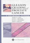 Cover of: Gleason Grading of Prostate Cancer by Mahul B Amin, David Grignon, Peter A Humphrey, John R Srigley