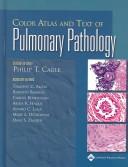 Cover of: Color Atlas and Text of Pulmonary Pathology by Philip T. Cagle, Timothy C. Allen, Philip T Cagle, Timothy C Allen, Roberto Barrios, Carlos Bedrossian, Abida K Haque, Philip T Cagle, Timothy C Allen, Roberto Barrios, Carlos Bedrossian, Abida K Haque