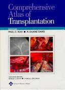 Cover of: Comprehensive Atlas of Transplantation | Paul C Kuo