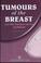 Cover of: Tumours of the breast and their treatment and cure by medicines