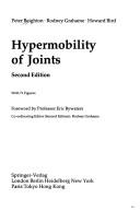 Hypermobility of joints by Peter Beighton