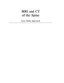 Cover of: MRI and CT of the spine: case study approach