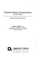 Cover of: Prostate biopsy interpretation by Jonathan I. Epstein