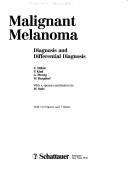 Cover of: Malignant melanoma: diagnosis and differential diagnosis