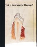 Cover of: What Is Periodontal Disease? by Joel M. Berns