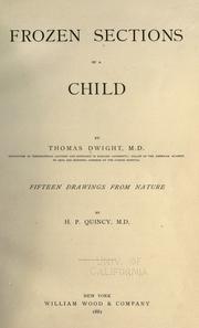 Cover of: Frozen sections of a child by Thomas Dwight, Thomas Dwight