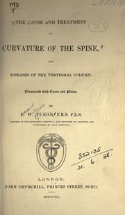 Cover of: The cause and treatment of curvature of the spine, and diseases of the vertebral column ...