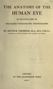 Cover of: anatomy of the human eye as illustrated by enlarged stereoscopic photographs.