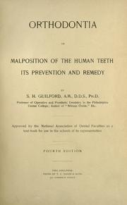 Orthodontia, or, malposition of the human teeth by Simeon Hayden Guilford