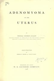 Cover of: Adenomyoma of the uterus