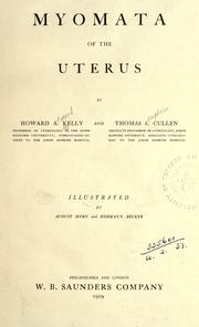 Cover of: Myomata of the uterus by Howard A. Kelly