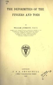 Cover of: The deformities of the fingers and toes. by Anderson, William