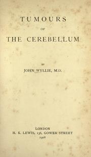 Cover of: Tumours of the cerebellum.