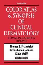 Cover of: Color Atlas & Synopsis of Clinical Dermatology | Thomas B. Fitzpatrick