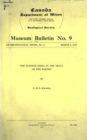 Cover of: The glenoid fossa in the skull of the Eskimo
