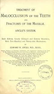 Cover of: Treatment of malocclusion of the teeth and fractures of the maxillae: Angle's system