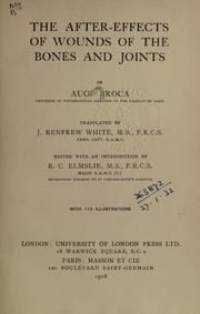 Cover of: after-effects of wounds of the bones and joints