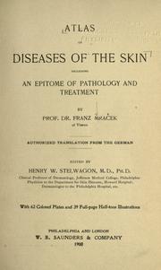 Cover of: Atlas of diseases of the skin by Franz Mracek
