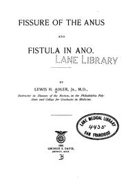 Fissure of the anus and fistula in ano by Adler, Lewis H. jr.