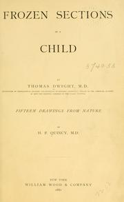 Cover of: Frozen sections of a child by Thomas Dwight, Thomas Dwight