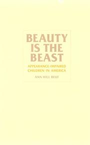 Cover of: Beauty is the beast: appearance-impaired children in America