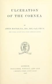 Cover of: Ulceration of the cornea. by Angus Macnab