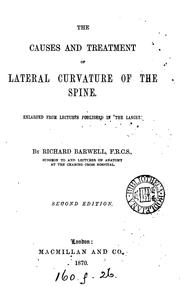 Cover of: The causes and treatment of lateral curvature of the spine: Enlarged from Lectures Published in ...