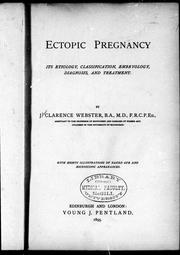 Cover of: Ectopic pregnancy: its etiology, classification, embryology, diagnosis, and treatment