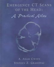 Emergency CT scans of the head by A. Adam Cwinn