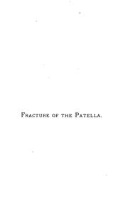 Cover of: Fracture of the patella
