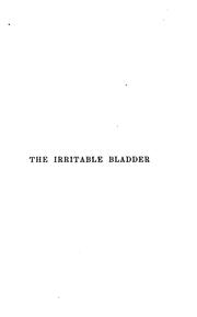 Cover of: The Irritable bladder by Frederick James Gant, Frederick James Gant