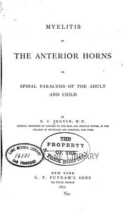 Cover of: Myelitis of the anterior horns, or, Spinal paralysis of the adult and child