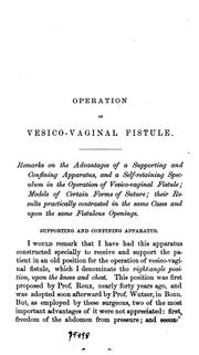 Cover of: Operation of vesico-vaginal fistule without the aid of assistants | Nathan Bozeman